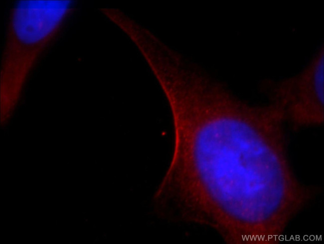 MYH14 Antibody in Immunocytochemistry (ICC/IF)