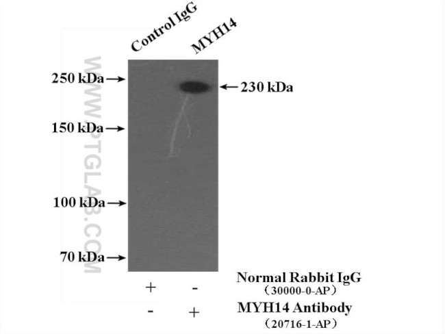 MYH14 Antibody in Immunoprecipitation (IP)
