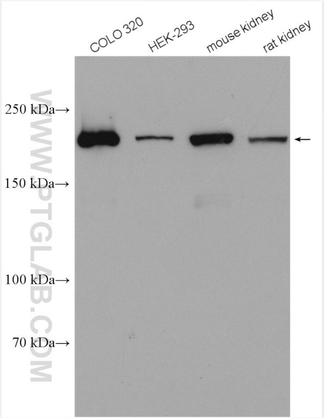 MYH14 Antibody in Western Blot (WB)