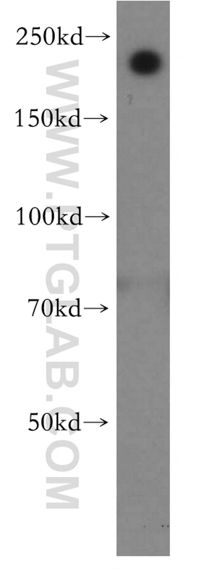 MYH14 Antibody in Western Blot (WB)