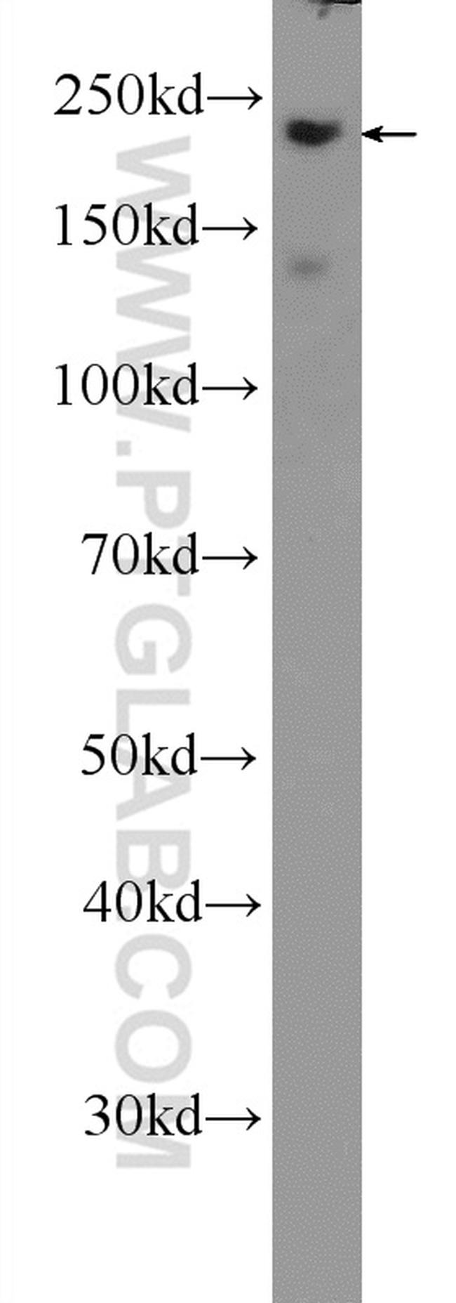 MYH14 Antibody in Western Blot (WB)