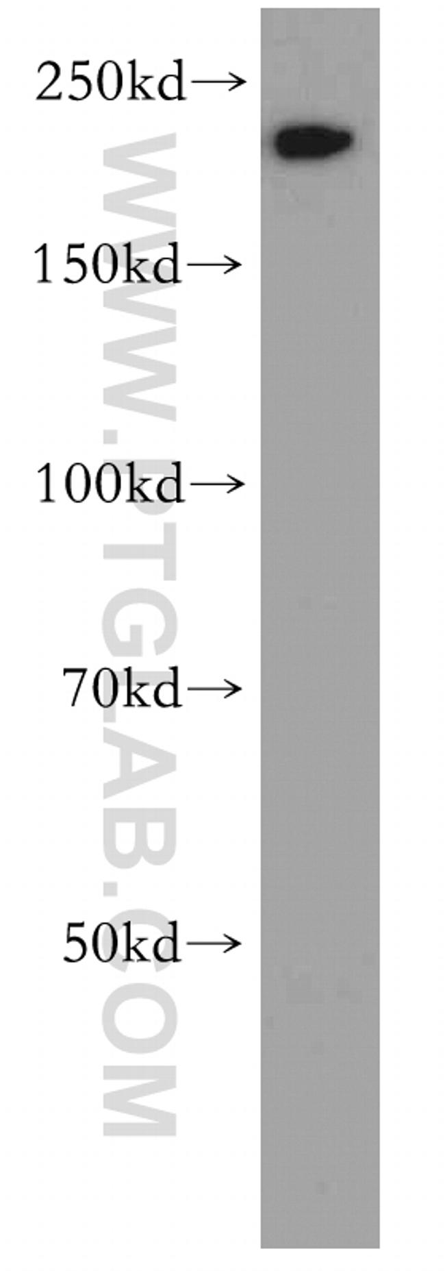 MYH14 Antibody in Western Blot (WB)