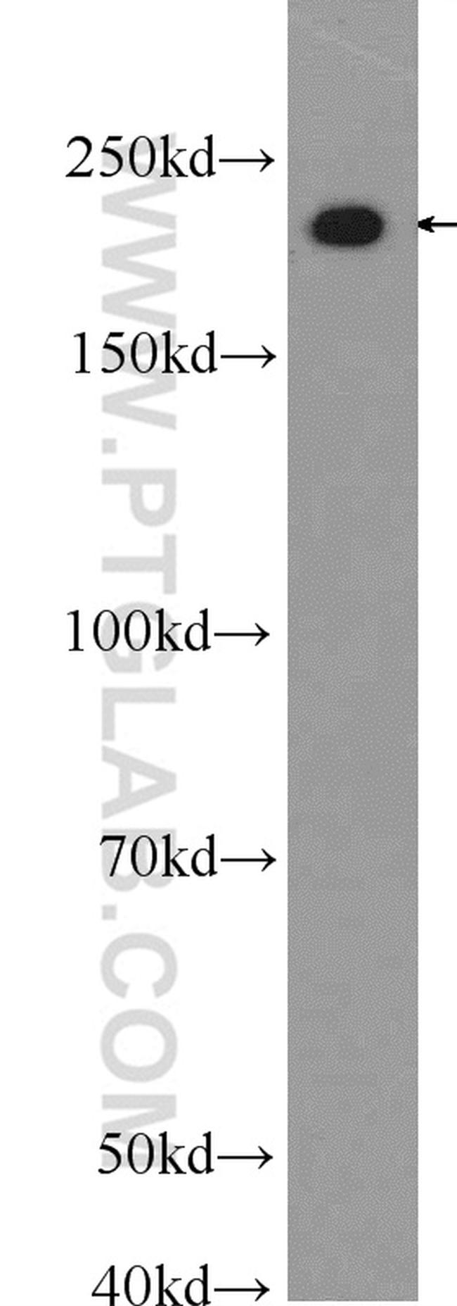 MYH14 Antibody in Western Blot (WB)