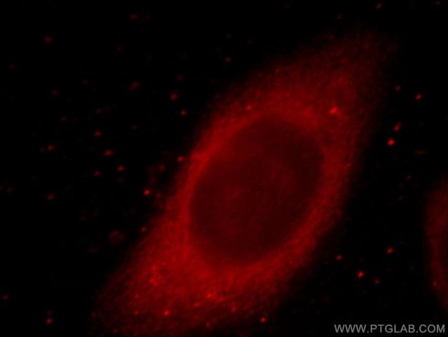 MYO7A Antibody in Immunocytochemistry (ICC/IF)