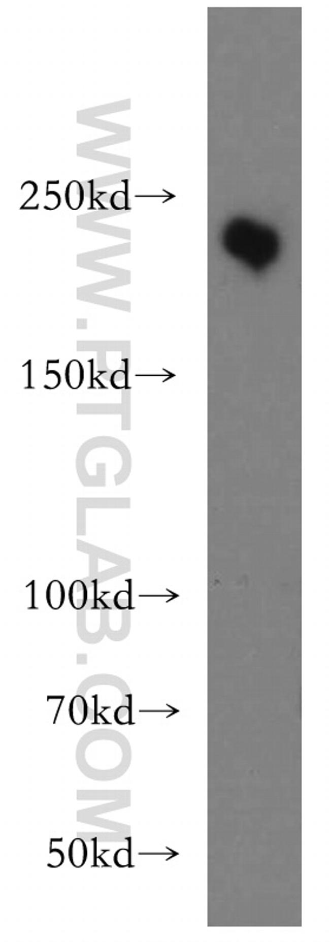 MYO7A Antibody in Western Blot (WB)