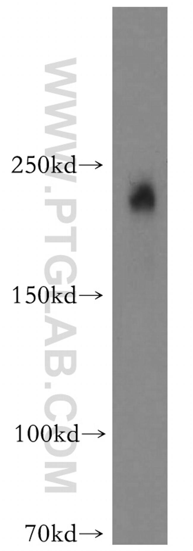 MYO7A Antibody in Western Blot (WB)