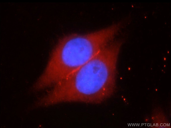 SYNM Antibody in Immunocytochemistry (ICC/IF)