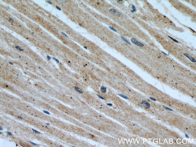 SYNM Antibody in Immunohistochemistry (Paraffin) (IHC (P))