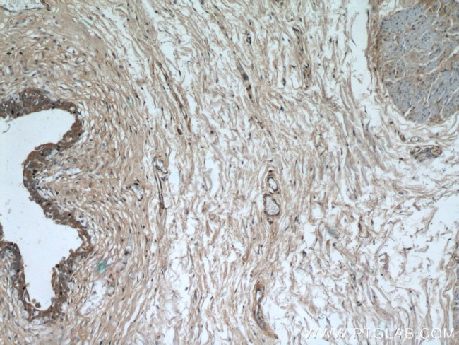 SYNM Antibody in Immunohistochemistry (Paraffin) (IHC (P))