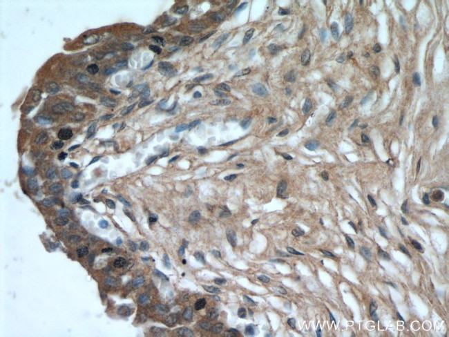 SYNM Antibody in Immunohistochemistry (Paraffin) (IHC (P))