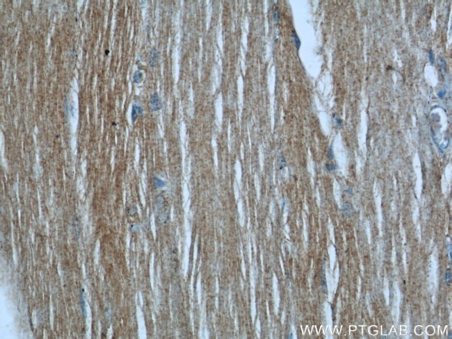 SYNM Antibody in Immunohistochemistry (Paraffin) (IHC (P))