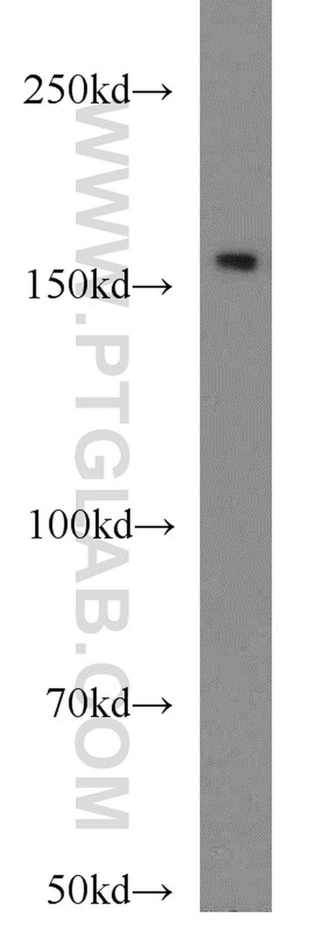 SYNM Antibody in Western Blot (WB)