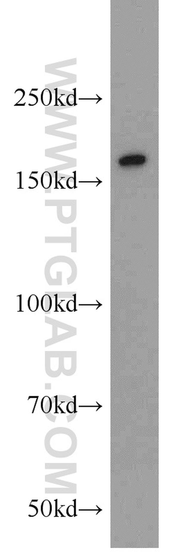 SYNM Antibody in Western Blot (WB)