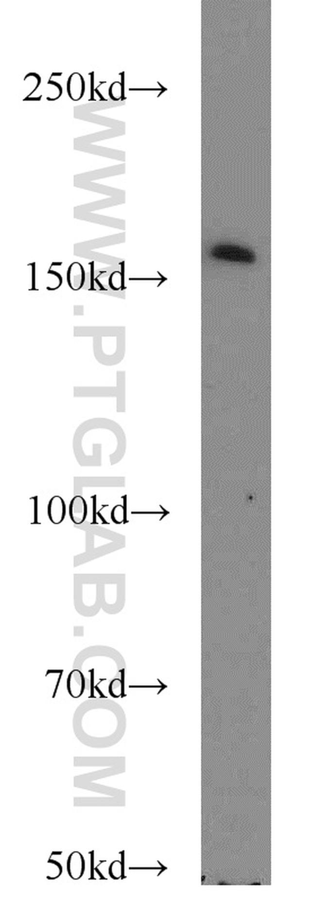 SYNM Antibody in Western Blot (WB)