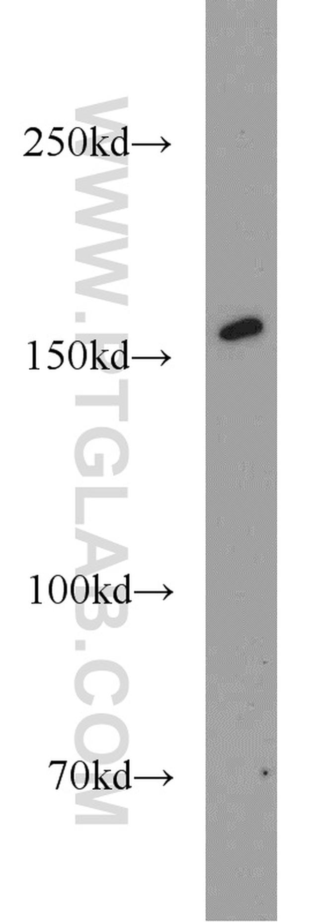 SYNM Antibody in Western Blot (WB)