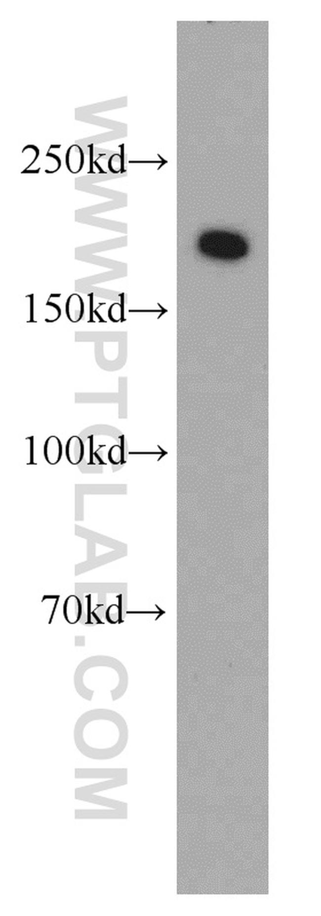 SYNM Antibody in Western Blot (WB)