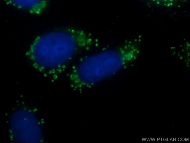 CFTR Antibody in Immunocytochemistry (ICC/IF)