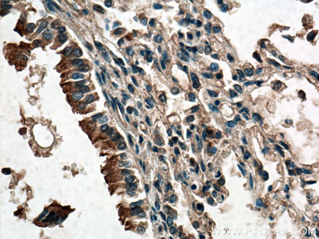 CFTR Antibody in Immunohistochemistry (Paraffin) (IHC (P))