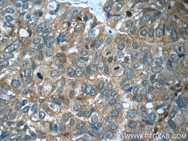 CFTR Antibody in Immunohistochemistry (Paraffin) (IHC (P))