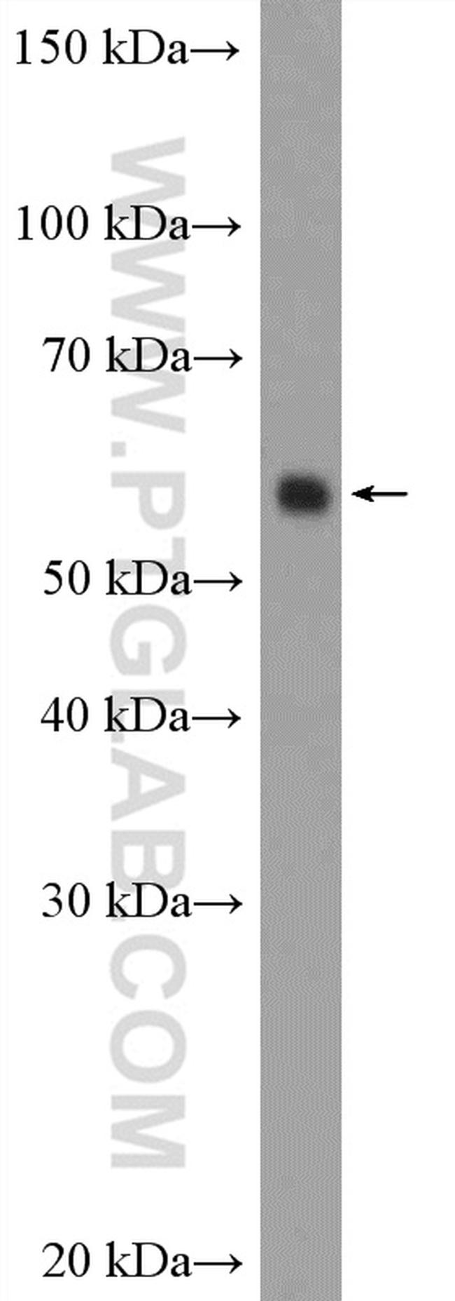 ARX Antibody in Western Blot (WB)