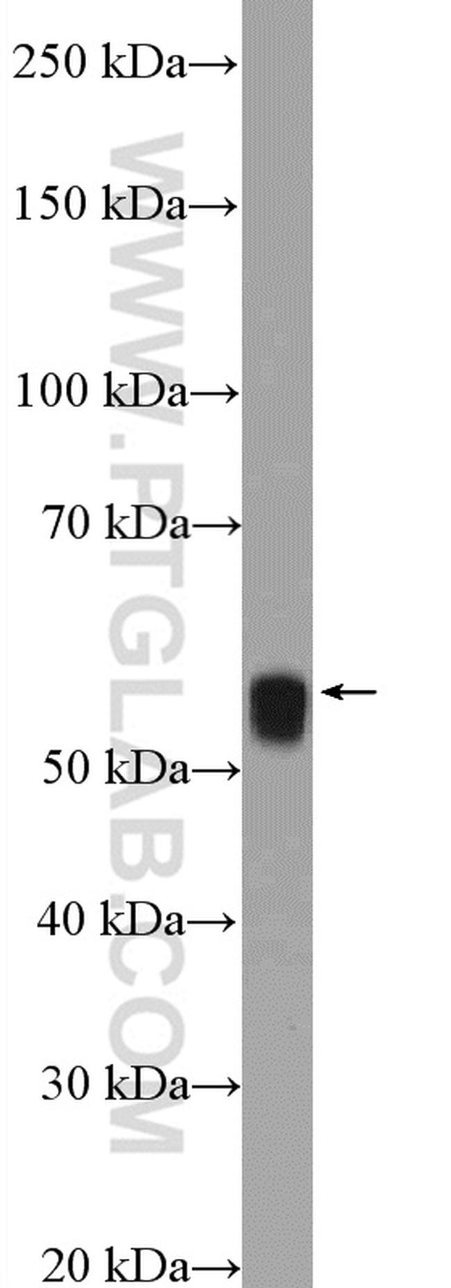 ARX Antibody in Western Blot (WB)