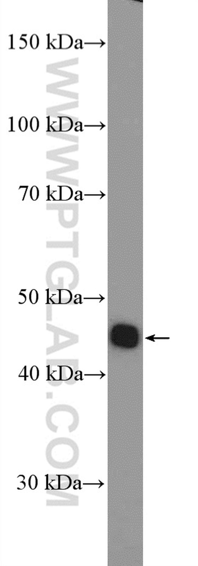 LHX3 Antibody in Western Blot (WB)