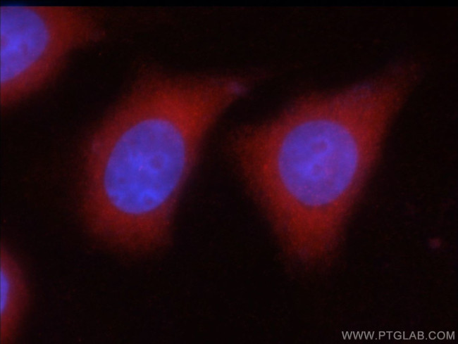 GAD65 Antibody in Immunocytochemistry (ICC/IF)