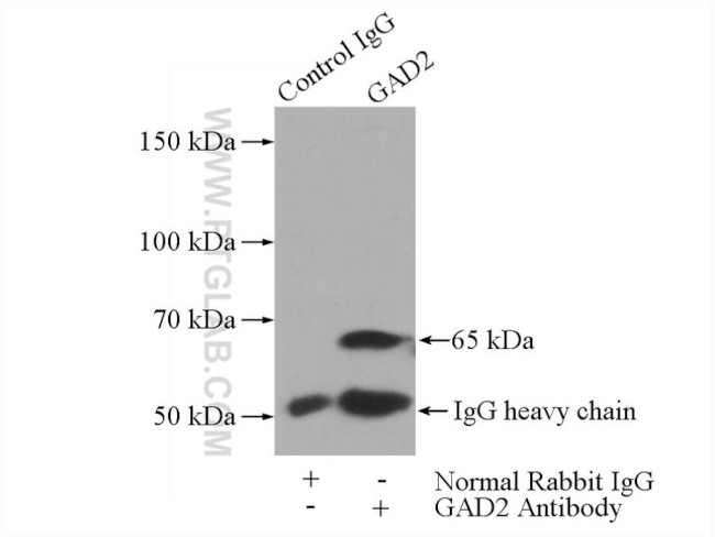 GAD65 Antibody in Immunoprecipitation (IP)