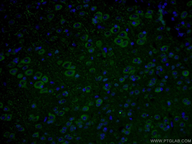 CHAT Antibody in Immunohistochemistry (PFA fixed) (IHC (PFA))