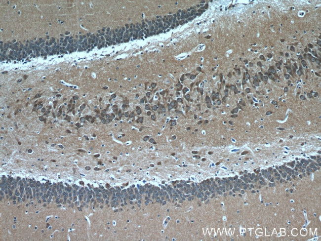 CHAT Antibody in Immunohistochemistry (Paraffin) (IHC (P))