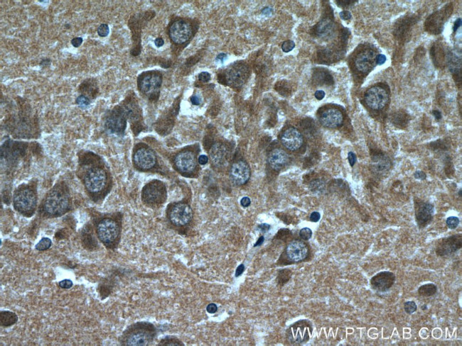 CHAT Antibody in Immunohistochemistry (Paraffin) (IHC (P))