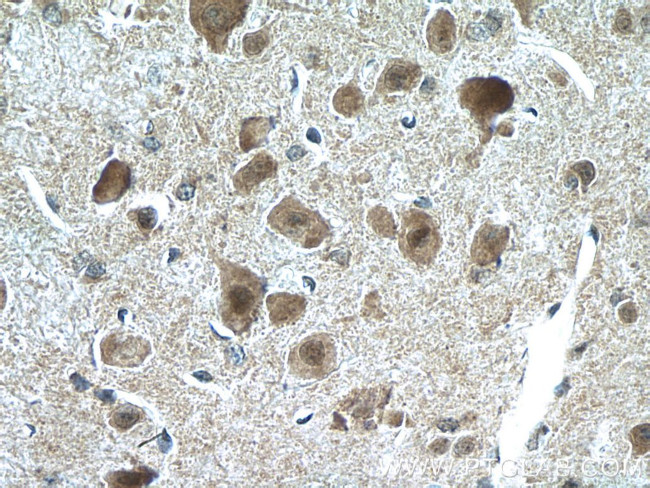 CHAT Antibody in Immunohistochemistry (Paraffin) (IHC (P))