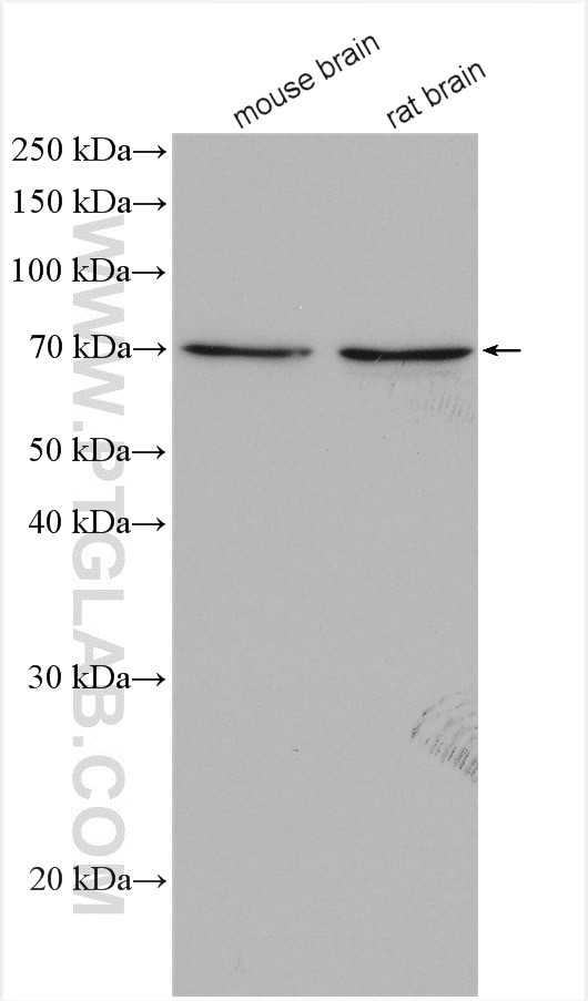 CHAT Antibody in Western Blot (WB)