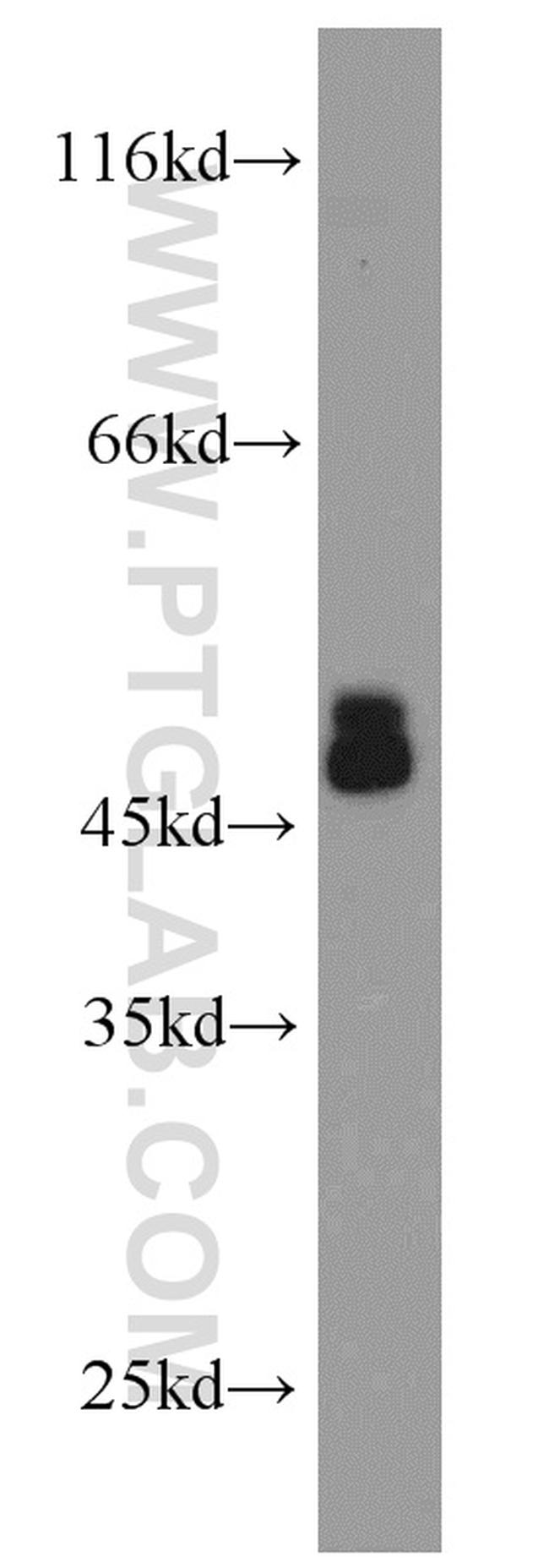 CHAT Antibody in Western Blot (WB)