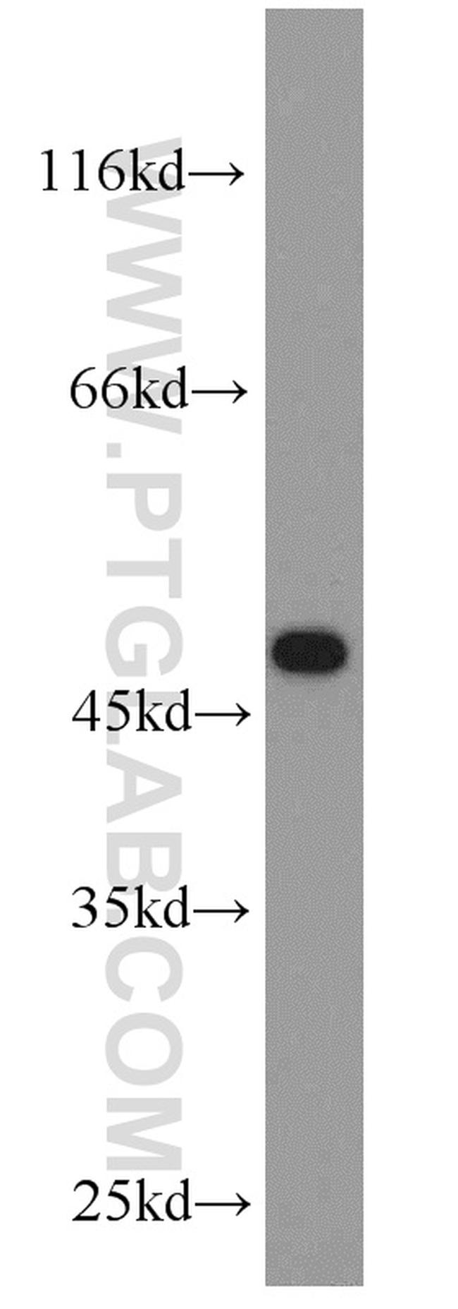 CHAT Antibody in Western Blot (WB)