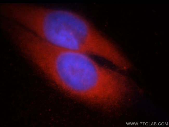 CHAT Antibody in Immunocytochemistry (ICC/IF)