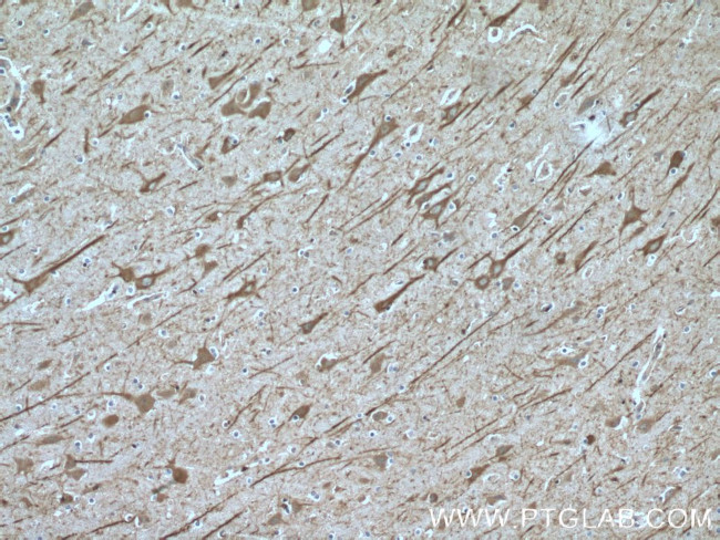 CHAT Antibody in Immunohistochemistry (Paraffin) (IHC (P))