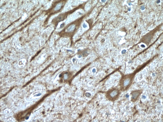 CHAT Antibody in Immunohistochemistry (Paraffin) (IHC (P))