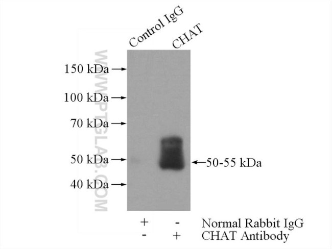 CHAT Antibody in Immunoprecipitation (IP)