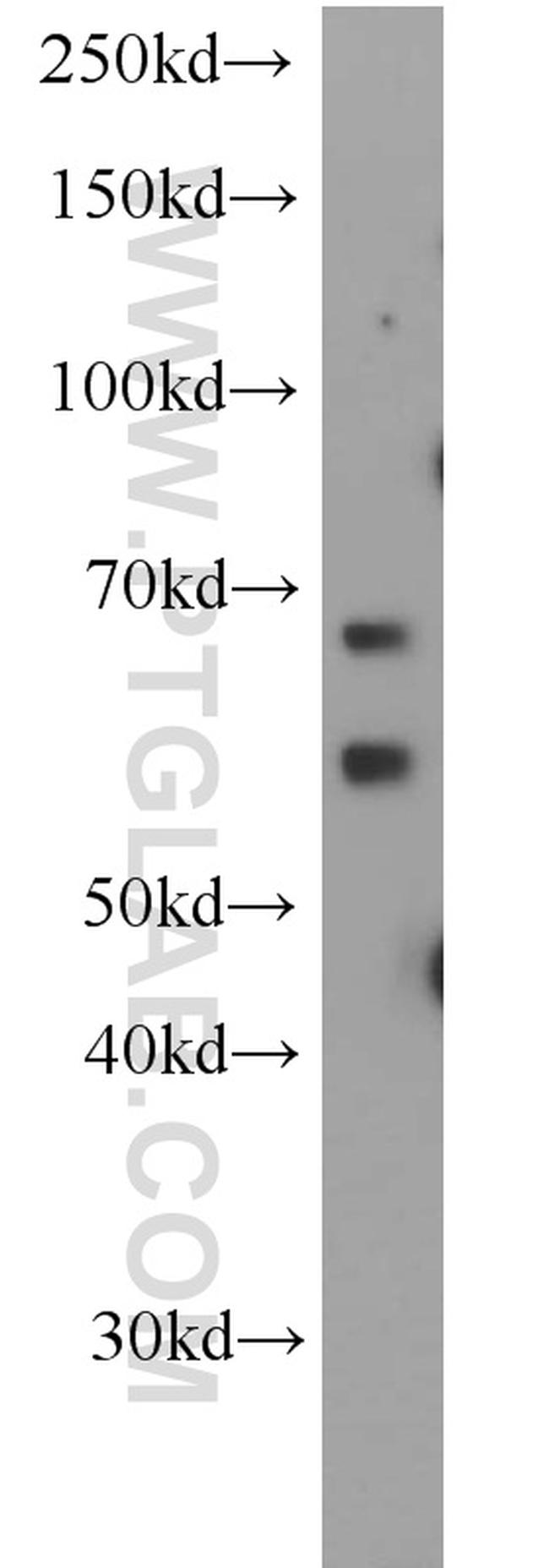 ALG6 Antibody in Western Blot (WB)