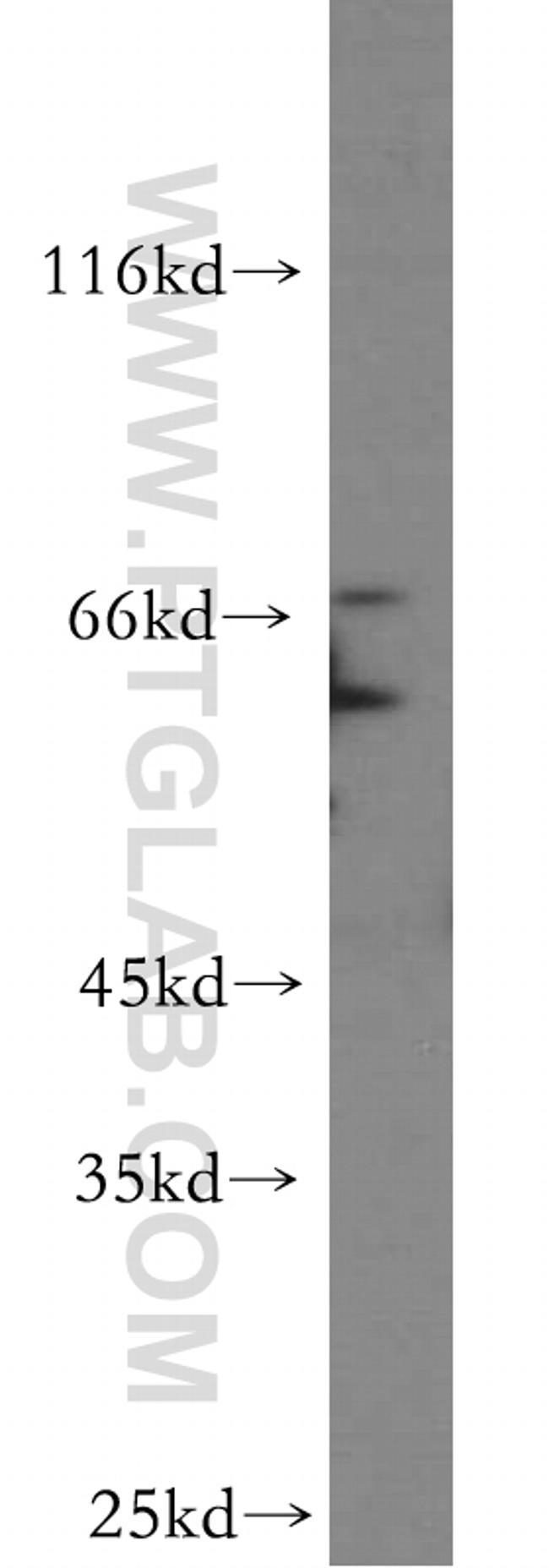 ALG6 Antibody in Western Blot (WB)