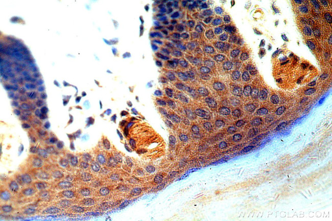 GSDMD Antibody in Immunohistochemistry (Paraffin) (IHC (P))