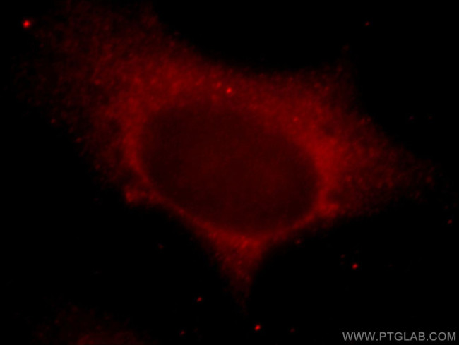 LIMS1 Antibody in Immunocytochemistry (ICC/IF)