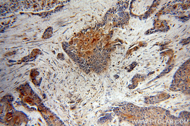 LIMS1 Antibody in Immunohistochemistry (Paraffin) (IHC (P))