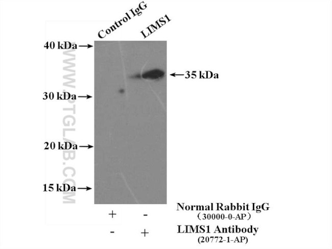 LIMS1 Antibody in Immunoprecipitation (IP)