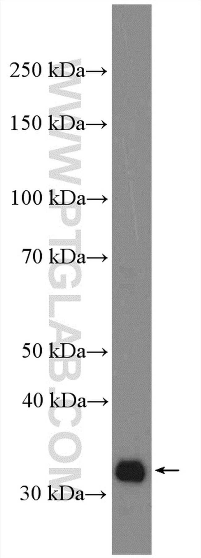 LIMS1 Antibody in Western Blot (WB)