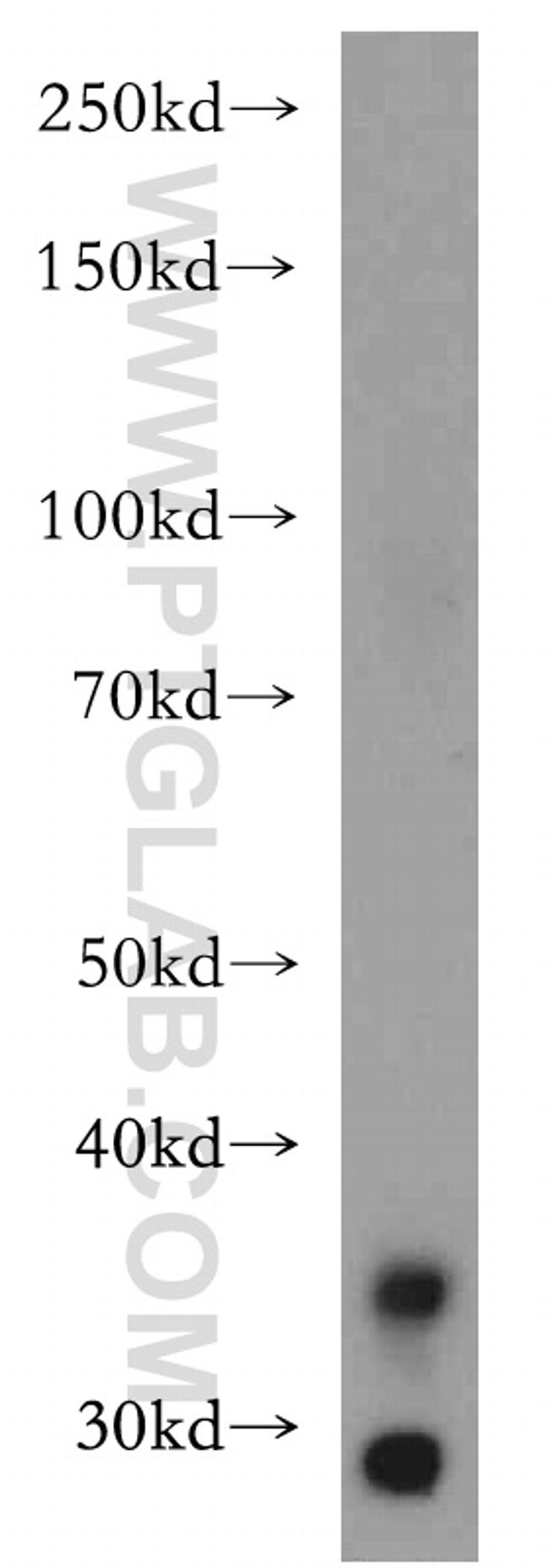 LIMS1 Antibody in Western Blot (WB)