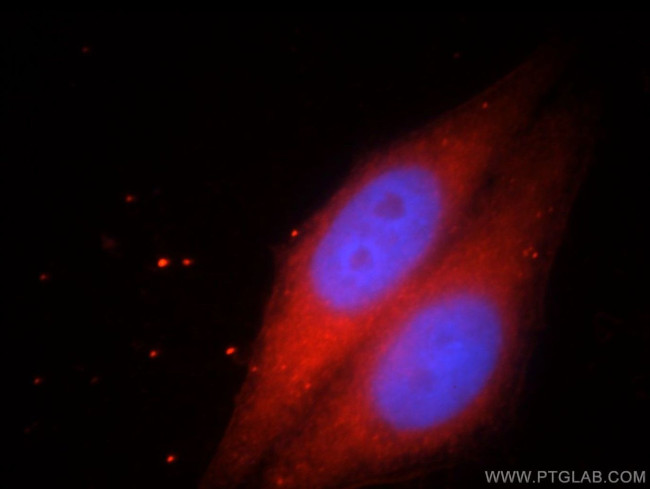 HPDL Antibody in Immunocytochemistry (ICC/IF)