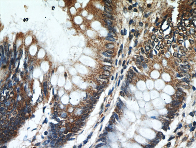 HPDL Antibody in Immunohistochemistry (Paraffin) (IHC (P))