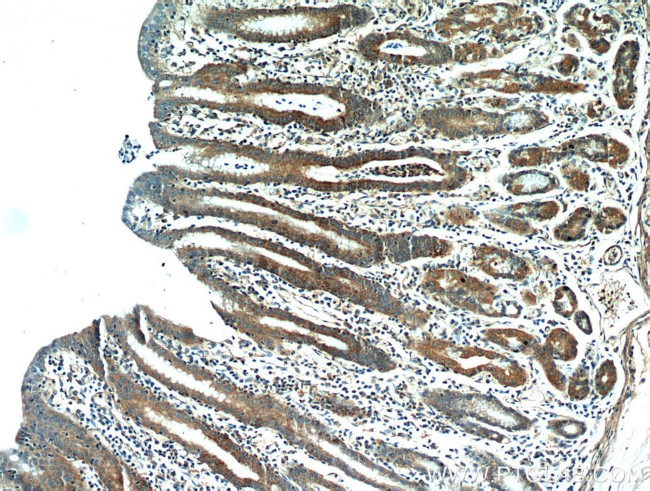 HPDL Antibody in Immunohistochemistry (Paraffin) (IHC (P))